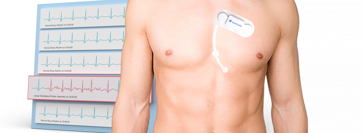 Добовий бездротовий моніторинг ЕКГ