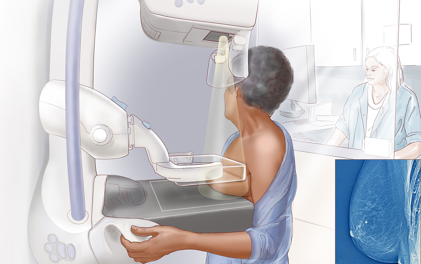 Мамографія