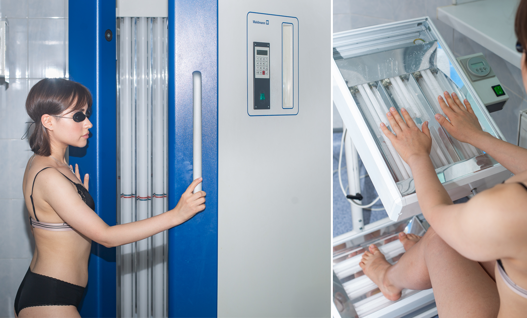 UVB фототерапия