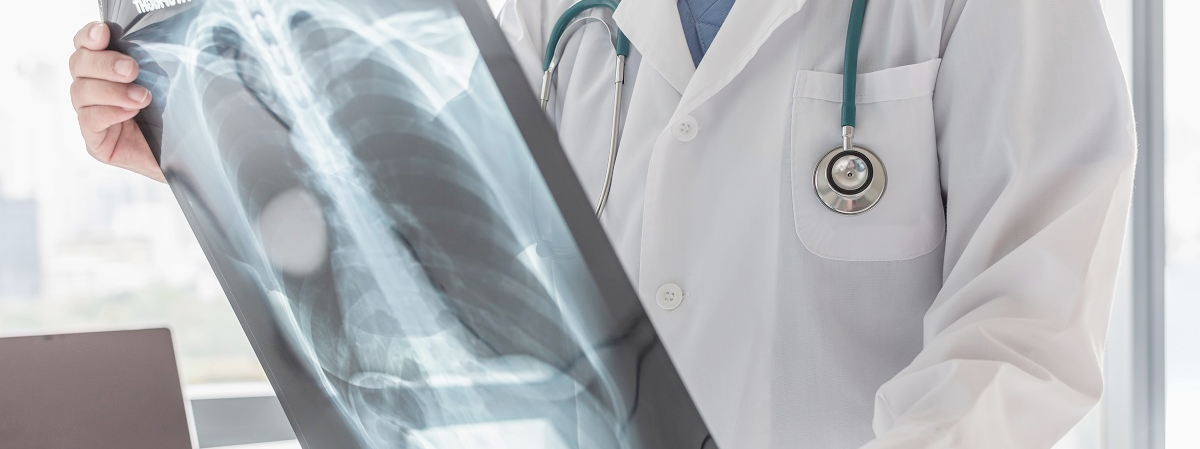 Рентген легень